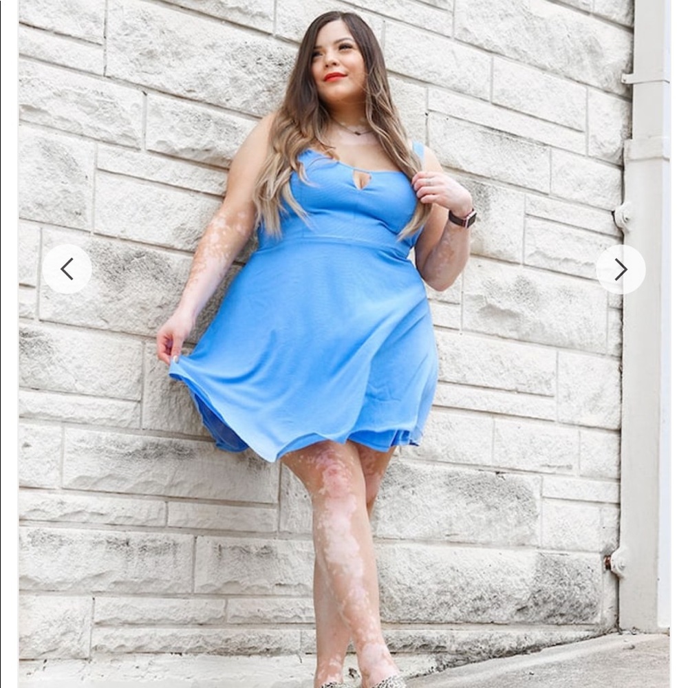 Forever 21 Light blue woven keyhole dress